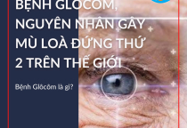 NGUYÊN NHÂN GÂY MẤT THỊ LỰC - GLAUCOMA (GLÔCÔM)