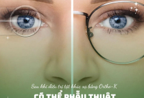 SAU KHI SỬ DỤNG KÍNH ÁP TRÒNG BAN ĐÊM ORTHO-K CÓ THỂ PHẪU THUẬT HOẶC ĐEO KÍNH GỌNG TRỞ LẠI KHÔNG